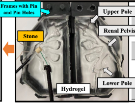 Transparent kidney model
